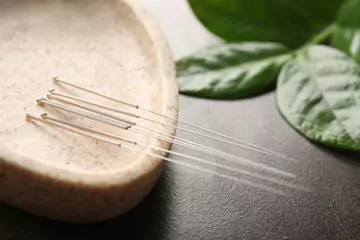 Is Acupuncture Right For You?